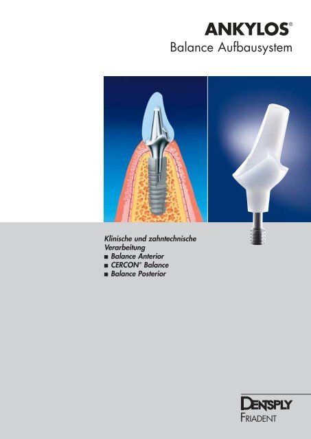 ANKYLOS® - DENTSPLY Friadent