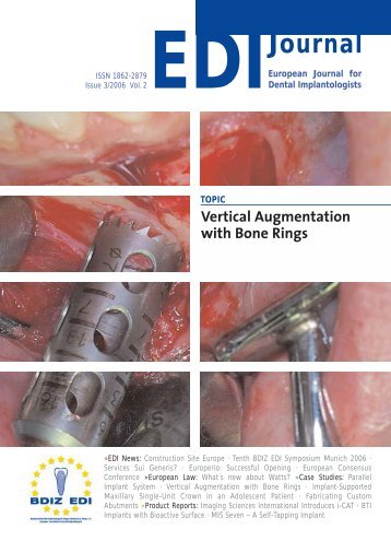 EDI - European Association of Dental Implantologists