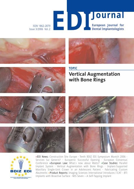 EUROPERIO - DENTSPLY Friadent