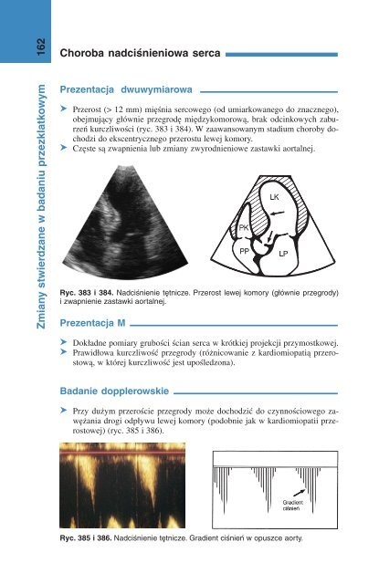 Choroba nadciśnieniowa serca 162 Zmian y stwierdzane w badaniu ...