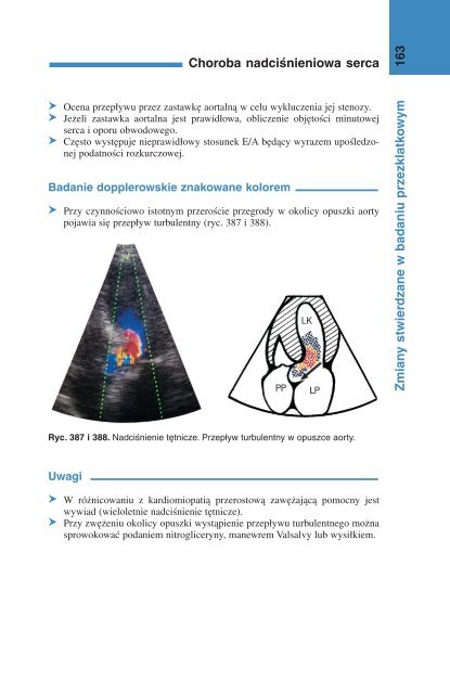 Choroba nadciśnieniowa serca 162 Zmian y stwierdzane w badaniu ...