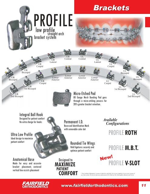 STRATUS BIOMERGE Brackets - Fairfield Orthodontics