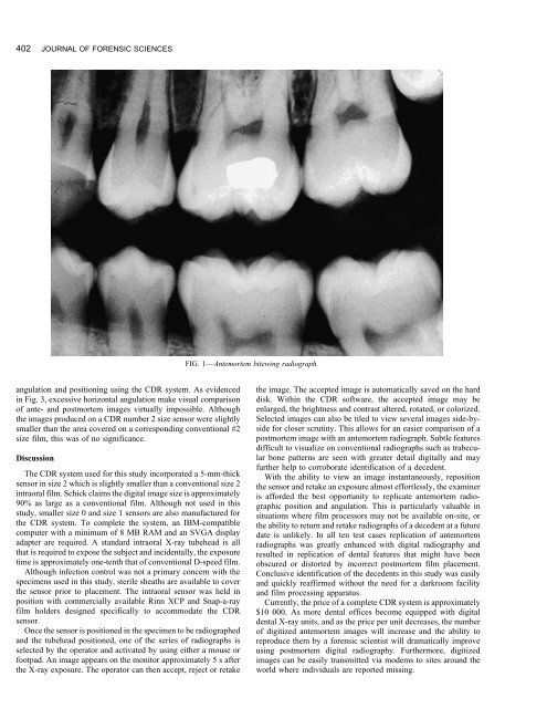 Computed dental radiography used to reproduce ... - Library