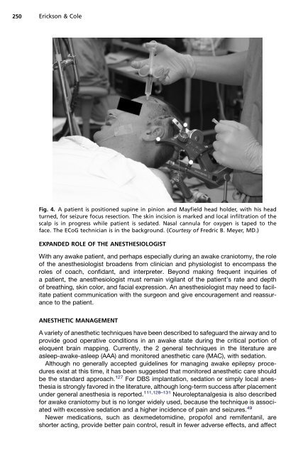 Anesthetic Considerations for Awake Craniotomy for Epilepsy ... - Vtr