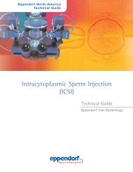 Intracytoplasmic Sperm Injection (ICSI) - Eppendorf