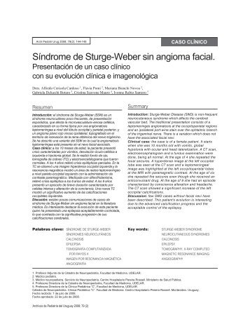 Síndrome de Sturge-Weber sin angioma facial.