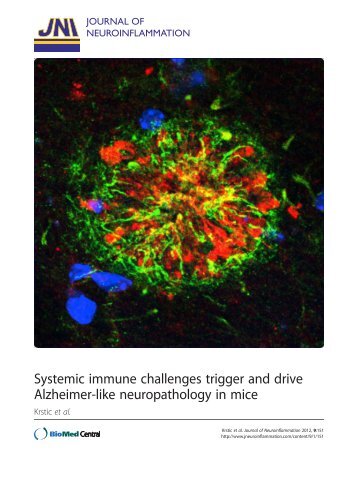 View PDF - Journal of Neuroinflammation