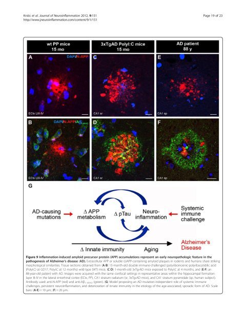 View PDF - Journal of Neuroinflammation