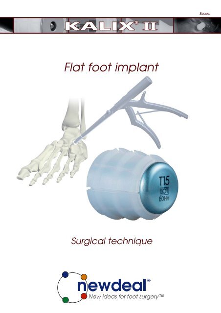 Flat foot implant