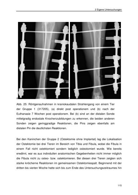 Messung des intraossealen Blutflusses zur Bestimmung der ...