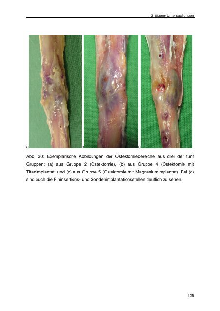 Messung des intraossealen Blutflusses zur Bestimmung der ...