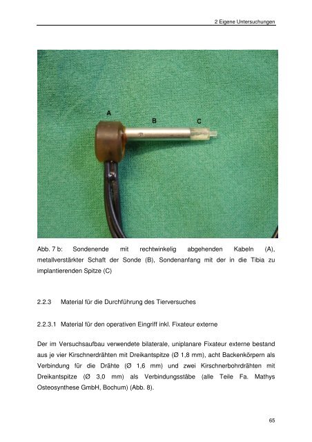 Messung des intraossealen Blutflusses zur Bestimmung der ...