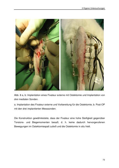 Messung des intraossealen Blutflusses zur Bestimmung der ...