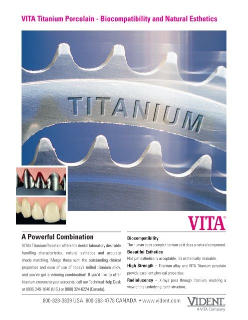 Vita Titanium Porcelain Biocompatibility And Natural Vident