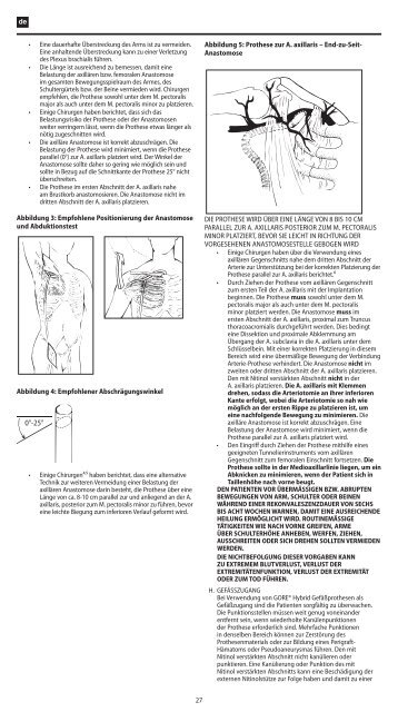 Instructions for Use - Multilingual - Gore Medical