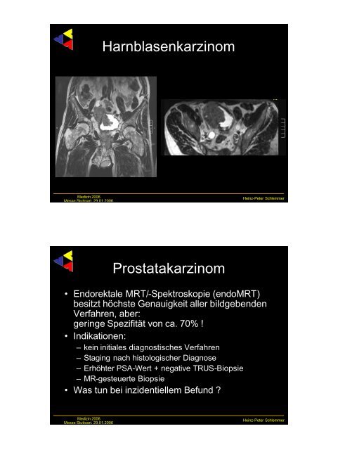 Frühe Bildgebung bei urologischen Tumoren