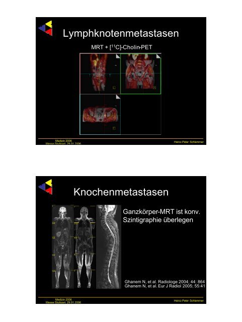 Frühe Bildgebung bei urologischen Tumoren