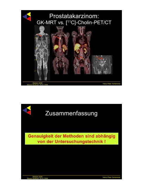 Frühe Bildgebung bei urologischen Tumoren