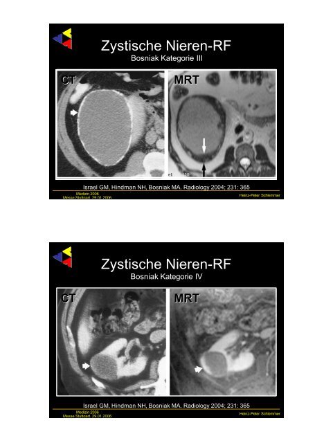 Frühe Bildgebung bei urologischen Tumoren