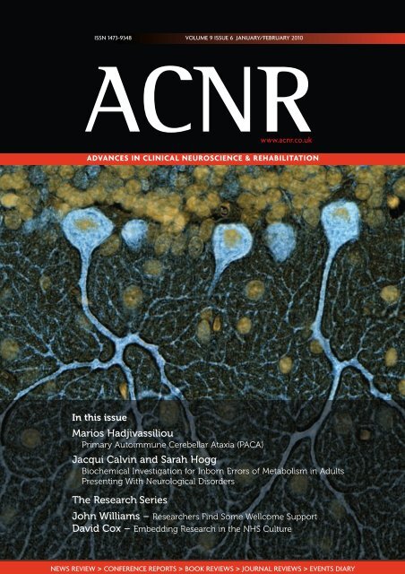 Marios Hadjivassiliou - Advances in Clinical Neuroscience and