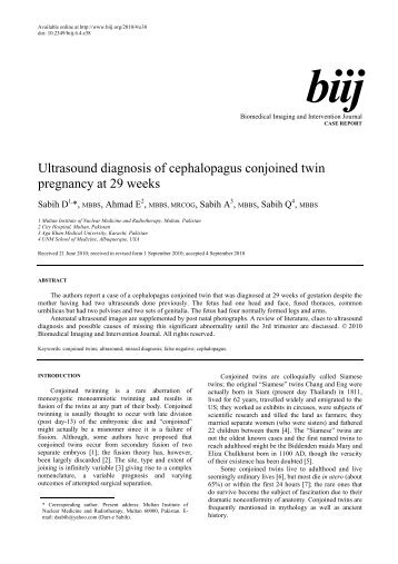 Ultrasound diagnosis of cephalopagus conjoined twin pregnancy at ...