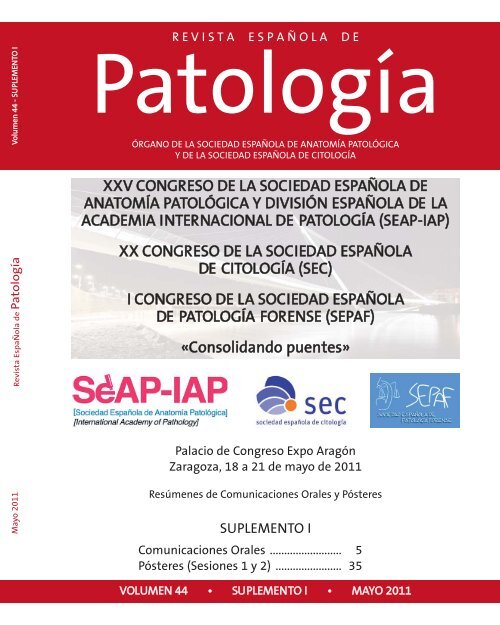 Patogenia del ameloblastoma unicístico de la hipertensión