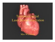 Transmyocardial Laser Revascularization
