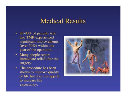 Transmyocardial Laser Revascularization