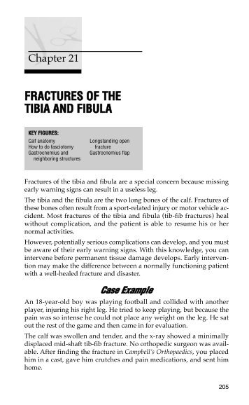 FRACTURES OF THE TIBIA AND FIBULA - Practical Plastic Surgery