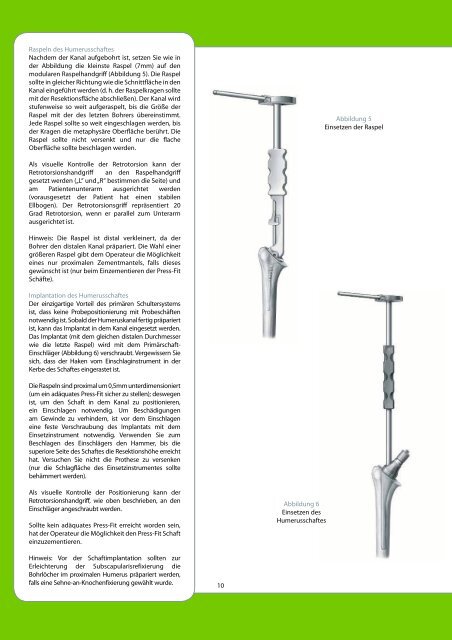 718-01-31 dt. Press-Fit OP Technik2 1 - tantum AG