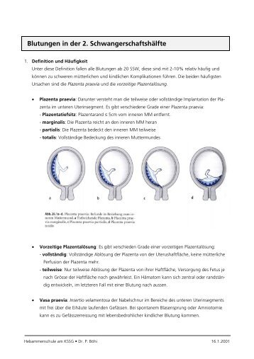 Blutungen in der 2. Schwangerschaftshälfte