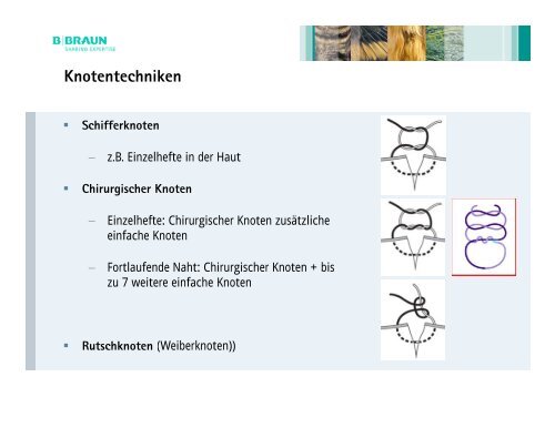 Moderne Nahtmaterialien und Nahttechniken der ChirurgieDr. Markus