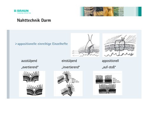 Moderne Nahtmaterialien und Nahttechniken der ChirurgieDr. Markus