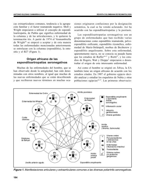 Historia de las espondiloartropatías seronegativas - Revista ...