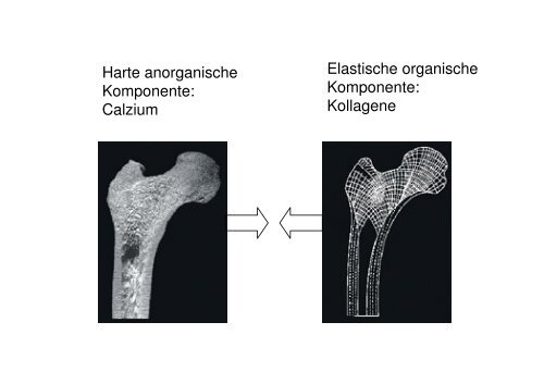 BIONIK KNOCHEN STATIK - IMST