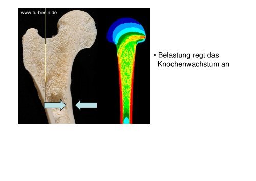 BIONIK KNOCHEN STATIK - IMST