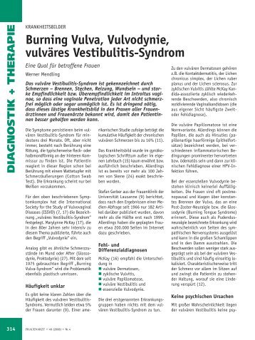 Burning Vulva, Vulvodynie, vulväres Vestibulitis-Syndrom - Frauenarzt