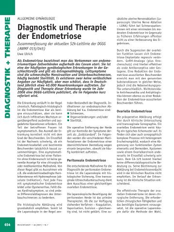 Diagnostik und Therapie der Endometriose - Frauenarzt