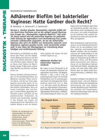 Adhärenter Biofilm bei bakterieller Vaginose: Hatte ... - Frauenarzt