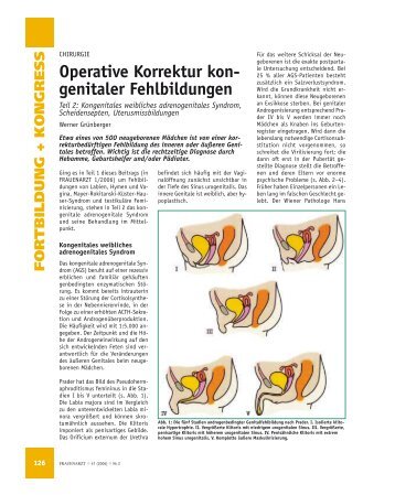 Operative Korrektur Kon- Genitaler Fehlbildungen  - Frauenarzt