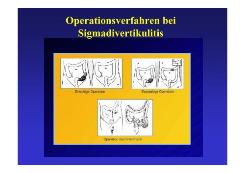 Carl M. Oneta Spital Zimmerberg Horgen - Dr. Carl Oneta