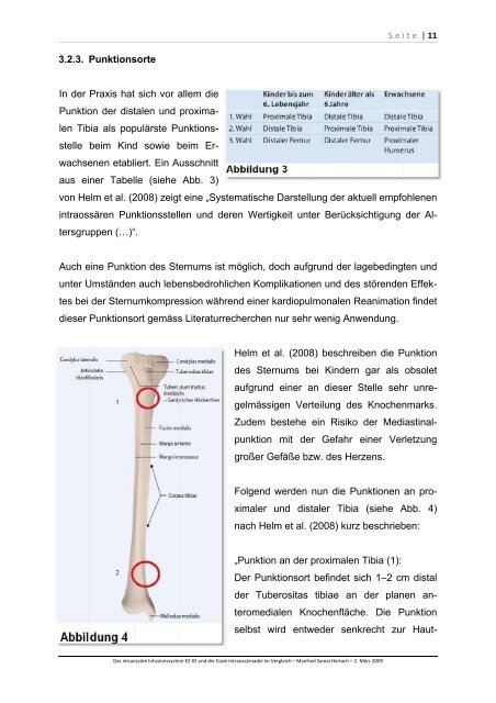 intraossaere-Systeme-im-Vergleich - Universitätsspital Basel