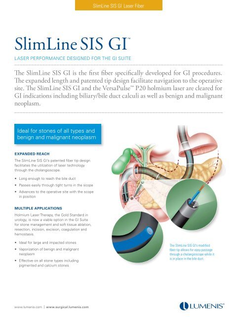 Lumenis Inc. 0644-016-01 SlimLine EZ 200µm - SIS Fiber