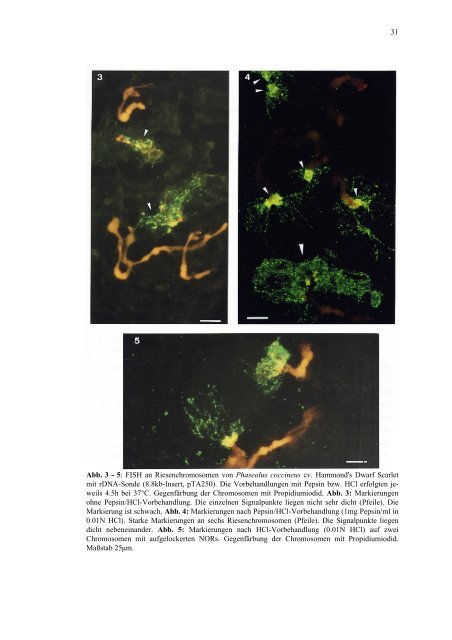 Verbesserte Fluoreszenz-in situ Hybridisierung (FISH ... - Mario Nenno