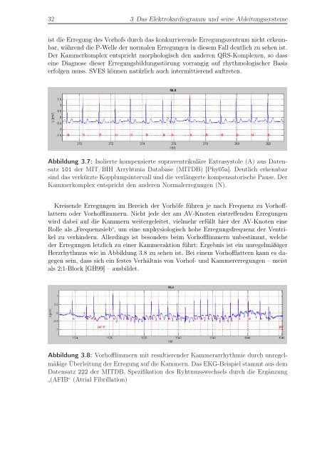 Entwicklung von Methoden zur Echtzeitanalyse von EKG ... - FZI