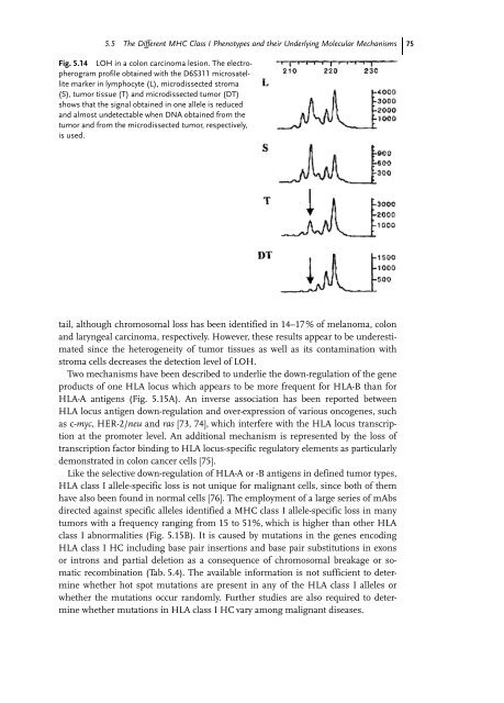 Cancer Immune Therapy Edited by G. Stuhler and P. Walden ...