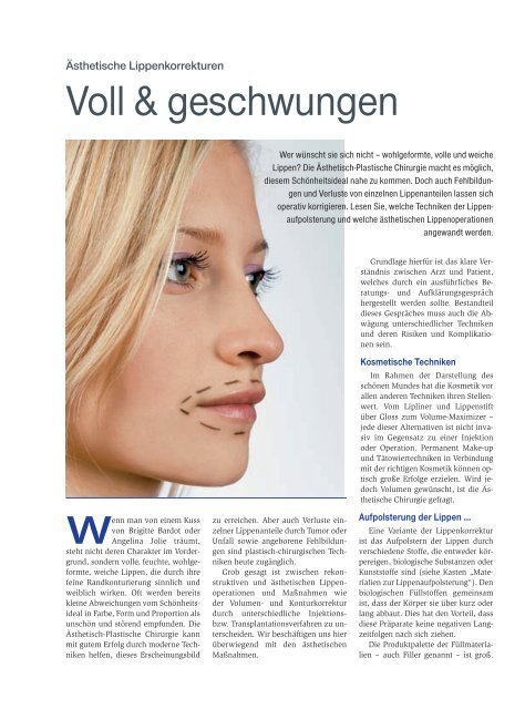 Lippen - Plastische Chirurgie Dr. Reus