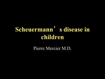 Scheuermann's disease in children - CHU Sainte-Justine