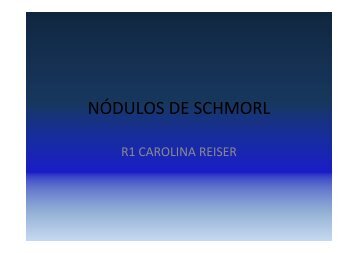 NÓDULOS DE SCHMORL - Sidi