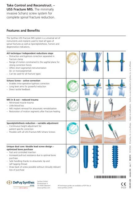 Synthes Screw Chart